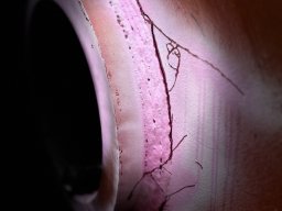 teaserbox_2493814492